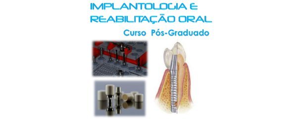 Curso Pós-Graduado em Implantologia e Reabilitação Oral