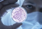 Derivados de bactérias envolvidos na doença periodontal podem induzir HIV
