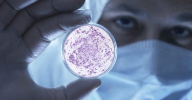 Derivados de bactérias envolvidos na doença periodontal podem induzir HIV
