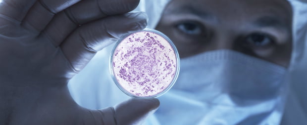 Derivados de bactérias envolvidos na doença periodontal podem induzir HIV