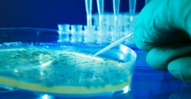 ESCMID divulga orientações sobre infeções por biofilmes