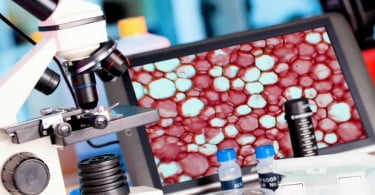 Investigadores nacionais estudam células estaminais cancerígenas e a ligação à quimioterapia