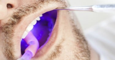 Laserterapia reduz efeitos secundários em doentes oncológicos