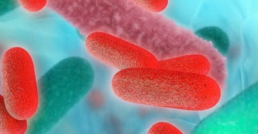 O que precisa saber sobre o surto de Legionella