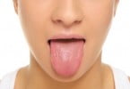 Exercícios orofaríngeos podem reduzir ressonar