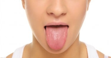 Exercícios orofaríngeos podem reduzir ressonar