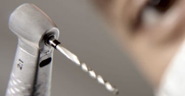 Pessoas que têm medo de ir ao dentista têm mais cáries dentárias