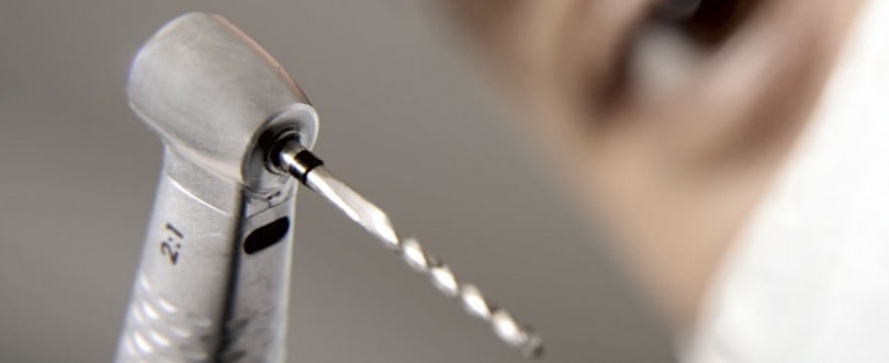 Pessoas que têm medo de ir ao dentista têm mais cáries dentárias