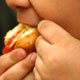 Crianças obesas apresentam menos cavidades dentárias