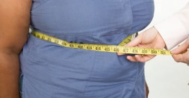 Obesidade pode afetar resultados de tratamentos periodontais