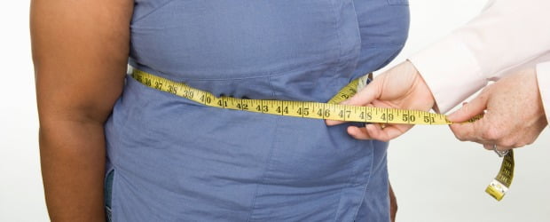 Obesidade pode afetar resultados de tratamentos periodontais