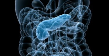 Descoberto novo gene no cancro do pâncreas