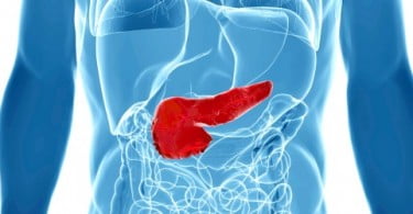 Doença periodontal pode aumentar risco de cancro do pâncreas