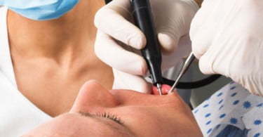 XVIII Curso Integral de Prótese Fixa