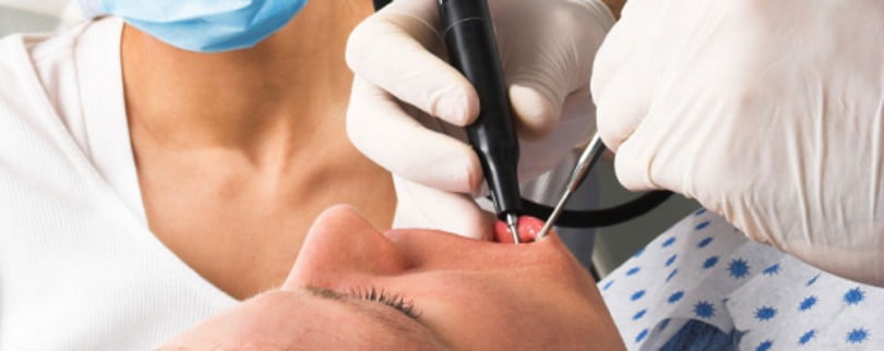 Curso de Aperfeiçoamento em Prótese Fixa sobre Dentes e Implantes