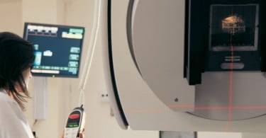 Nova terapia de radiação pode aliviar sintomas de boca seca em pacientes com cancro