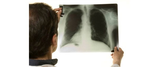 Identificada nova doença respiratória em paciente britânico