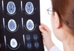 Tumor raro faz crescer dentes no cérebro de criança
