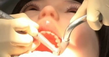 Dentistas japoneses revelam novas capacidades de Showa Hanako