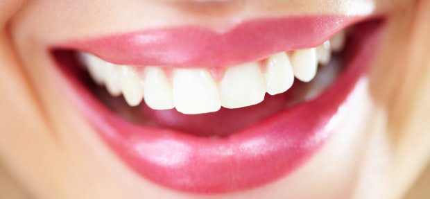 Dentes perfeitos são novo sinal de status
