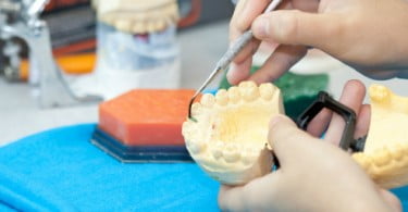 Transplante ósseo dispara no Brasil