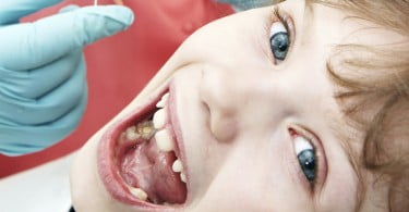 ONG internacional organiza triagem odontológica em Portugal