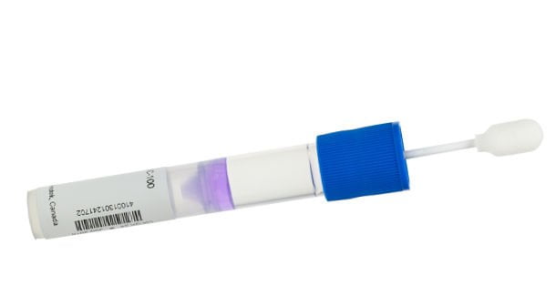Criado teste genético para detetar risco de doença periodontal