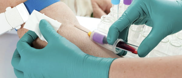 Testes de sangue podem identificar cancro da mama com anos de antecedência