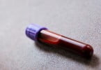 Amostra de sangue pode substituir biópsia