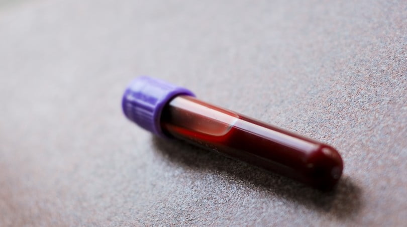 Amostra de sangue pode substituir biópsia