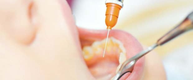 Estudo constata que a vacina de ADN inibe a formação de cáries
