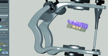 Zirkonzahn lança novo módulo CAD/CAM Articulador Virtual