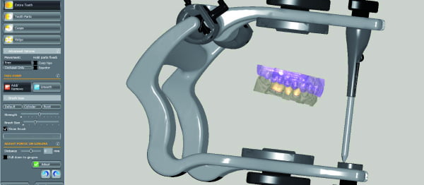 Zirkonzahn lança novo módulo CAD/CAM Articulador Virtual