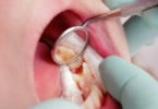 obturações dentárias outubro