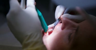 dor orofacial
