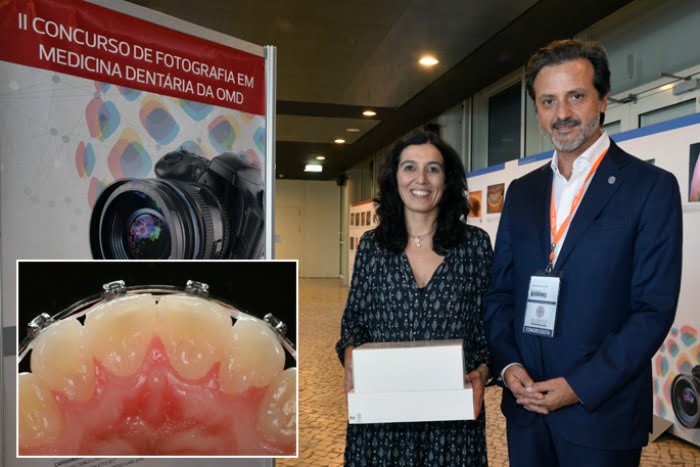 Alexandra Vinagre vencedora concurso de fotografia OMD