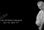 Curso de Estética Gengival Clínica Bonfante