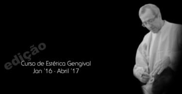 Curso de Estética Gengival Clínica Bonfante