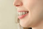 pessoa com aparelho dentário