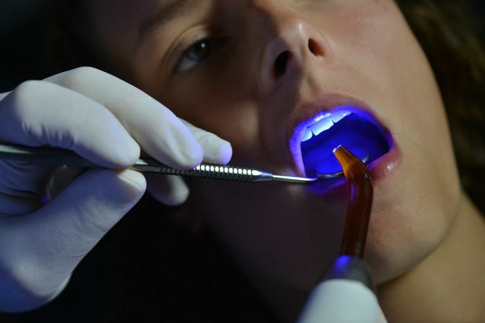 tratar cáries dentárias