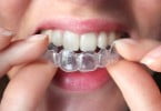Alineadent dentes