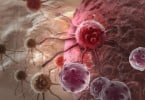 células cancerígenas