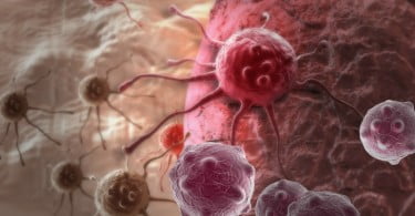 células cancerígenas