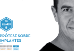 Prótese sobre Implantes CV Dental