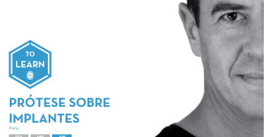 Prótese sobre Implantes CV Dental