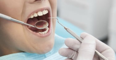 higienista oral criança Saúde Oral