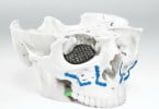 Transplante facial Promodel