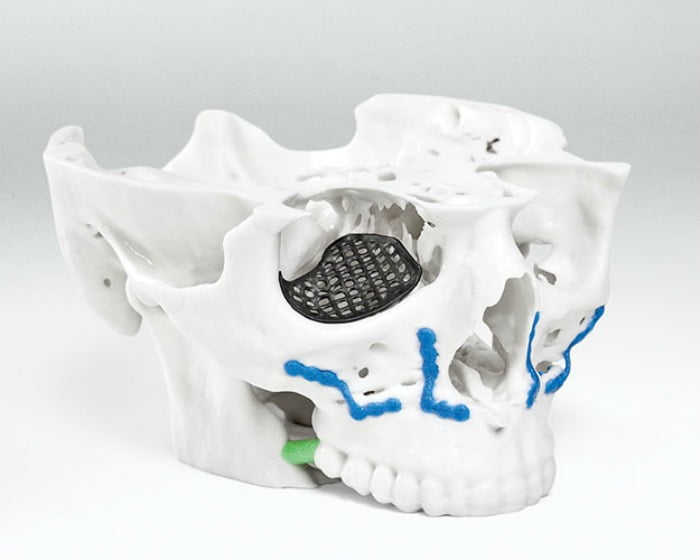 Transplante facial Promodel