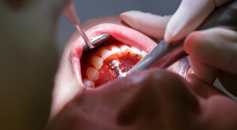 Governo quer alargar cheque-dentista aos reclusos