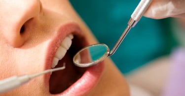 paciente no dentista